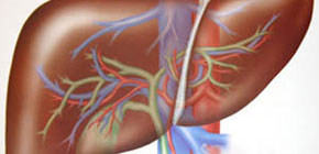 精不液化早期癥狀是怎樣的